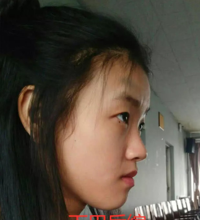 经常用"嘴巴"呼吸的人,颜值会发生变化?网友:一直张嘴