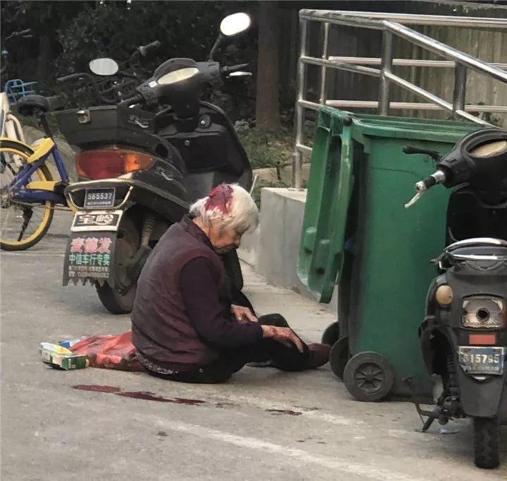 丰泽花园小区内高空抛物又伤人 记者现场了解:现状