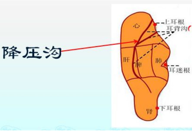 高血压,不怕,耳朵上有一条降压沟,每天揉一揉,血压一