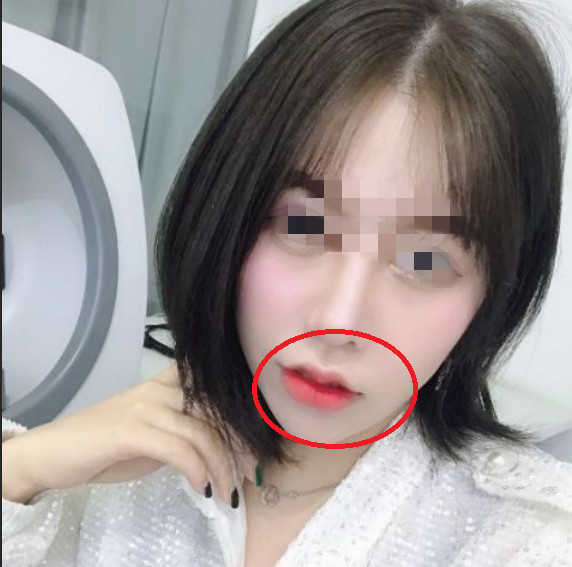有这3种"嘴型"的女生,其他五官好看也没用,颜值基本为0
