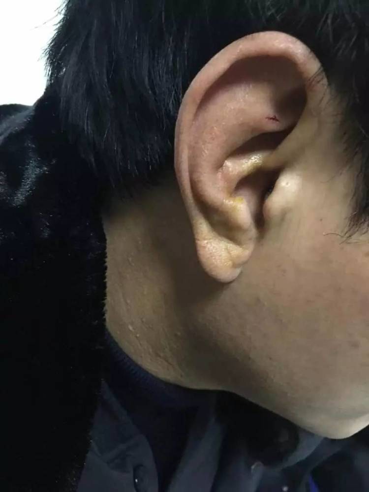 天津交警抓酒驾司机去太平间醒酒 遭扇耳光(组图)