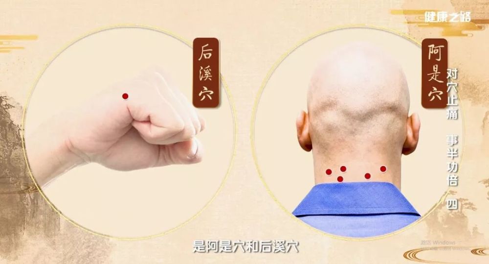 阿是穴,后溪穴