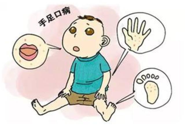 4月要当心,四类传染病孩子最易中招,重点