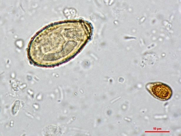 肝吸虫,简称华支睾吸虫.成虫寄生于人体的肝胆管内,可引起肝吸虫病.