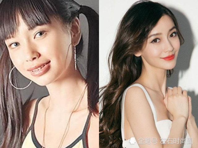 整牙如"换脸"的明星,杨颖成"神颜",没想到高圆圆以前