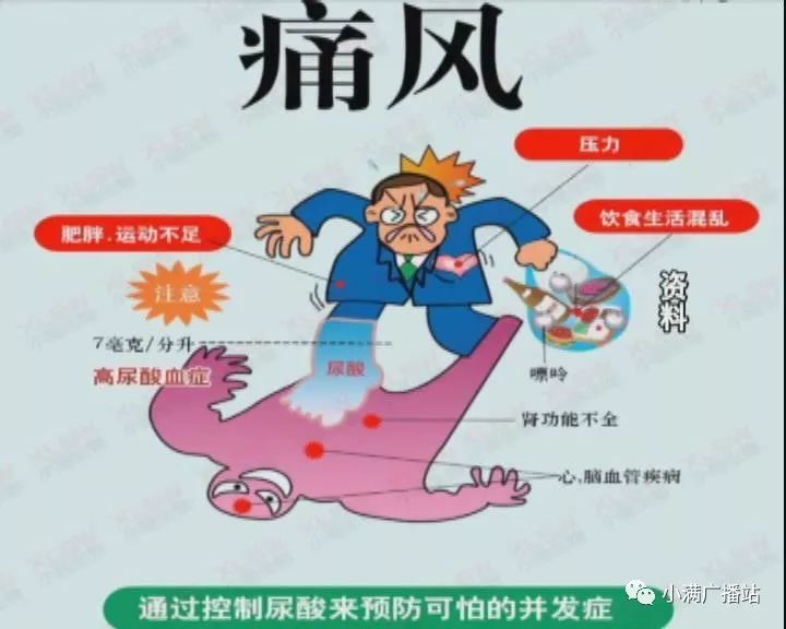 【小满话健康】全民关注痛风日:痛风发病年轻化 合理饮食是预防关键