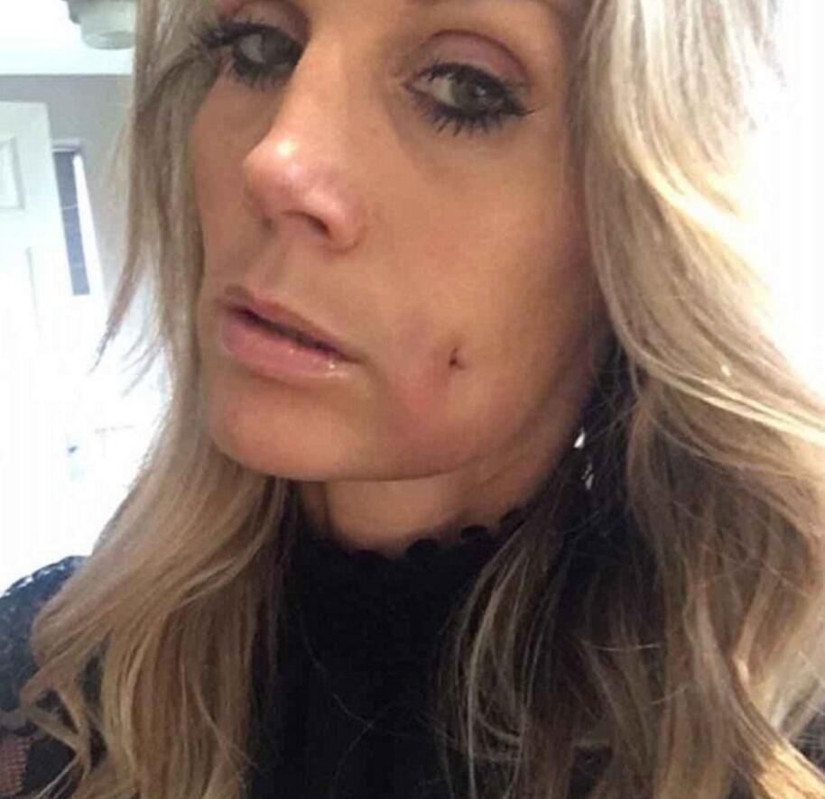 她花上万在脸上打了个洞 竟是为了这个 (组图)