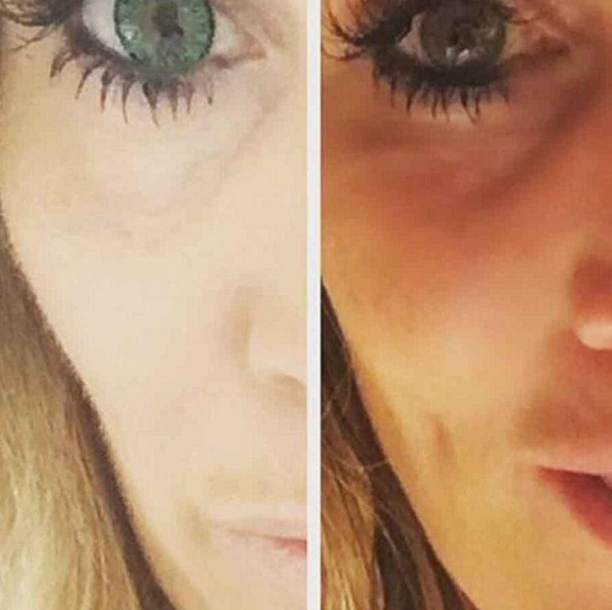 她花上万在脸上打了个洞 竟是为了这个 (组图)