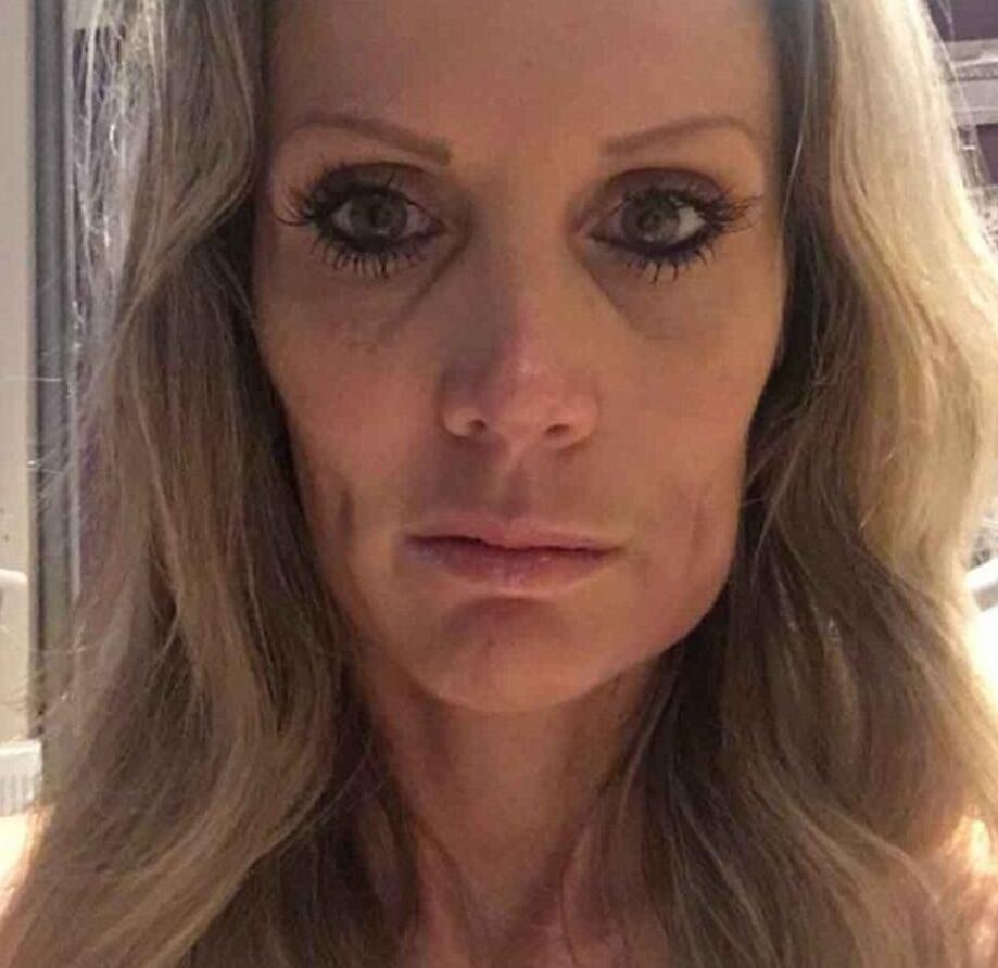 她花上万在脸上打了个洞 竟是为了这个 (组图)