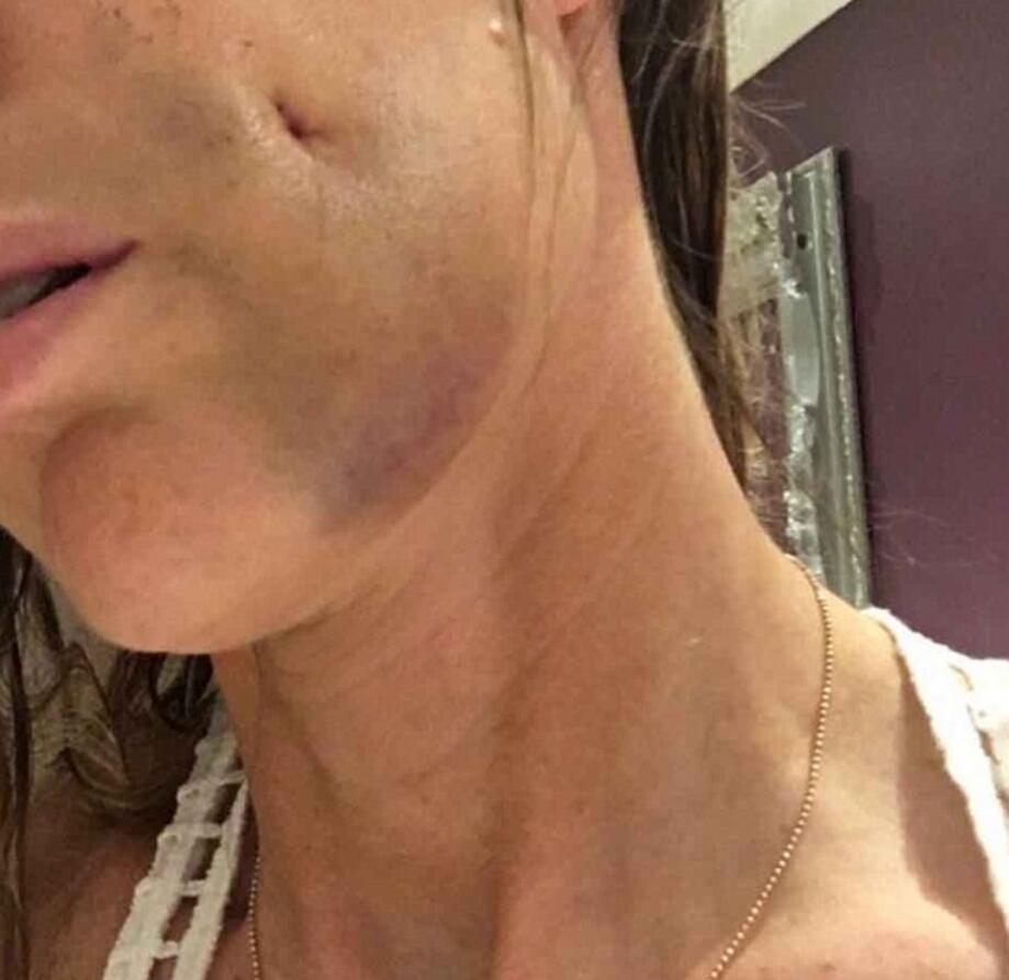 她花上万在脸上打了个洞 竟是为了这个 (组图)