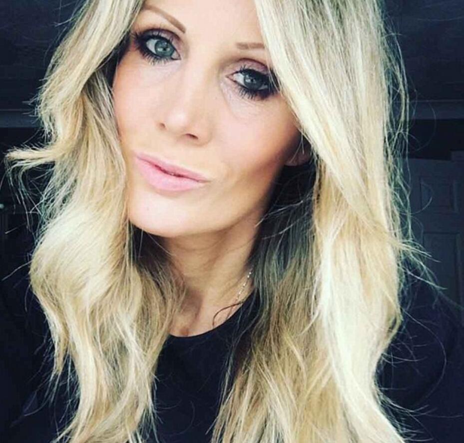 她花上万在脸上打了个洞 竟是为了这个 (组图)