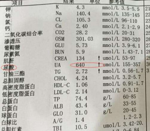 3种食物可升高尿酸,加速肾脏衰竭,尿酸超标的人少吃