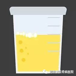 尿里有泡沫就是肾病吗?医生教你正确认识泡沫尿