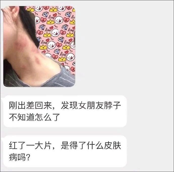 我们既不用它的学术名 也不用"种草莓" 而是一些别称 比如 有个男生