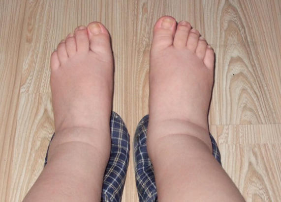 怀孕中后期,孕妇身体可能会出现这4种 情况 ,没中就很幸运了 