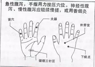 具体治疗方法:请伸开您的五指试试, 用力撑五指,也许会感到中指和食指