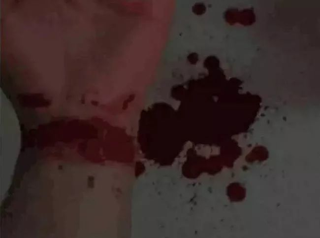 黄石一女子微信直播割腕自杀,厕所内大片血迹