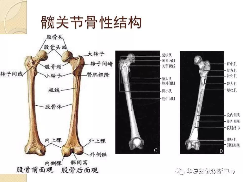 骨科精读|从髋关节的解剖到手术入路全过程,你要的解答全在这!