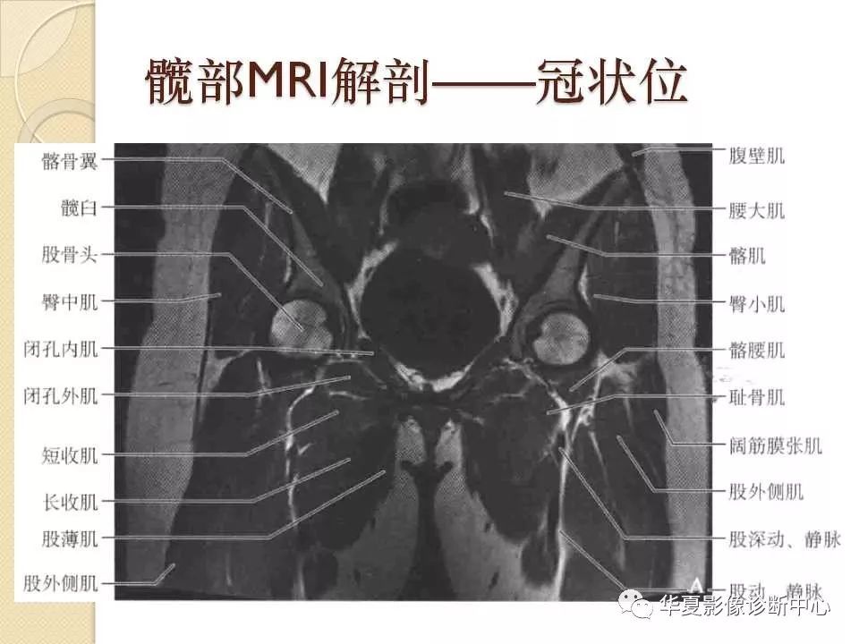 骨科精读|从髋关节的解剖到手术入路全过程,你要的解答全在这!