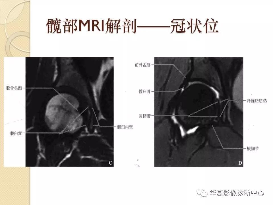 骨科精读|从髋关节的解剖到手术入路全过程,你要的解答全在这!