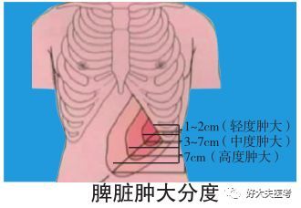 【每日技能】脾脏,肾脏触诊检查方法,得分标准及视频教程