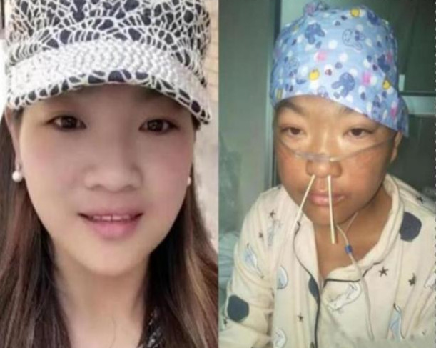 "村花"嫁给穷小伙, 不幸患病变丑后对方的做法令人落泪