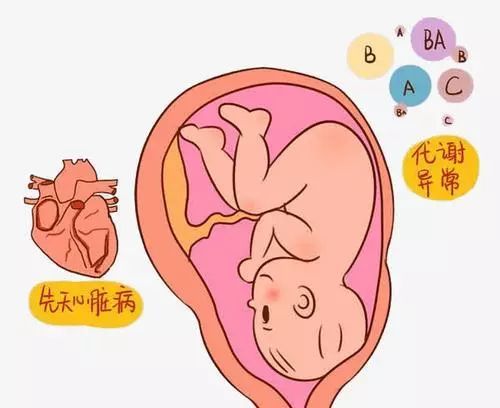先天性心脏病大多是胎儿时期心脏血管发育异常所造成的心血管畸形,其