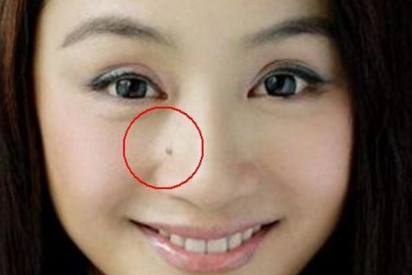 娱乐圈脸上有"标痣"的女星:热巴独特,最后一位美得让