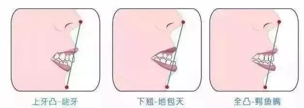 牙缝 