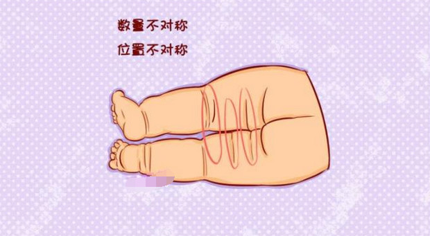 640