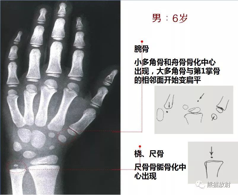 2019骨龄图谱收藏随时对照查看