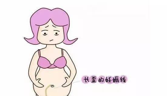 为何怀孕时肚子上会有黑线,黑线又代表什么?看完涨知识