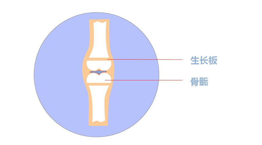 骨骺和骺板都是未成熟的四肢长骨的生长区域,也是儿童骨骼的最薄弱和