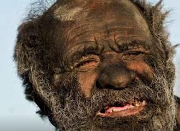 世界上最长时间不洗澡的人,看一眼,就让人头皮发麻