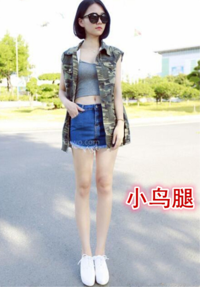 第1张图片就是筷子腿,其实筷子腿还是很正常的.