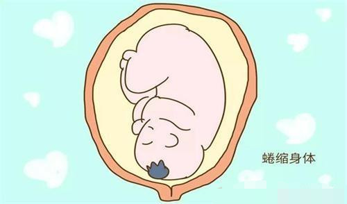 怀孕26周了,胎儿在肚子会是什么姿势呢?说出来你都不