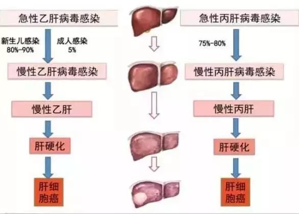 乙肝人口数_乙肝五项正常结果图(2)