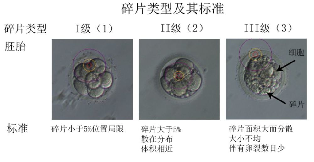 图6 囊胚的内细胞团和滋养层细胞分级及其标准