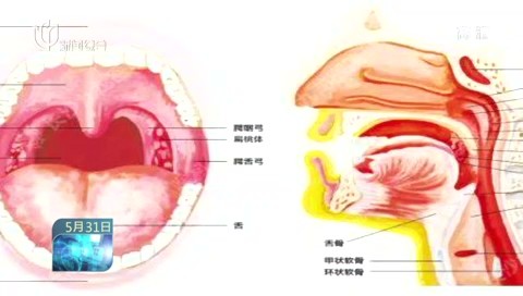 吃小龙虾后感到喉咙有异物难以吞咽 医生:急性会厌炎