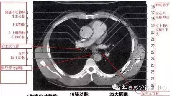 超详尽的胸部ct影像示意图赶紧收藏