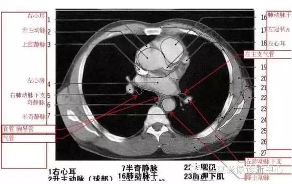 超详尽的胸部ct影像示意图赶紧收藏