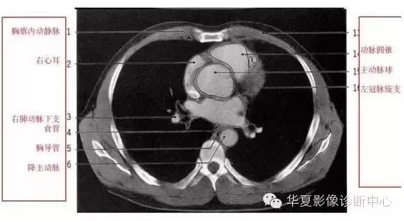 超详尽的胸部ct影像示意图赶紧收藏