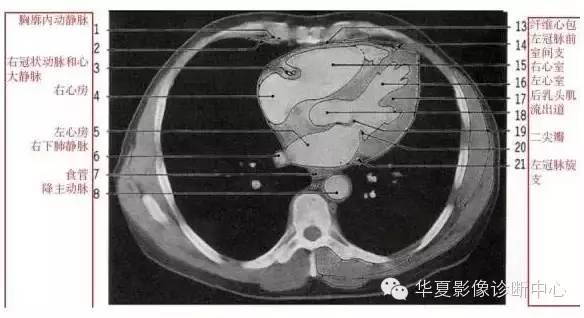 影像解剖▕胸部