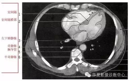 肺动脉窗层面主动脉弓层面主动脉弓上层面胸骨切迹层面纵膈窗右基底支