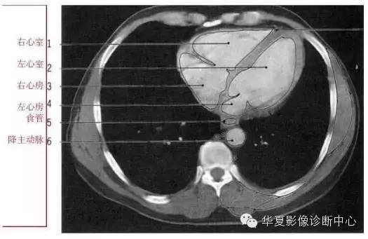影像解剖▕胸部