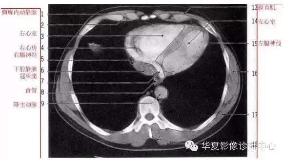 弓上层面胸骨切迹层面纵膈窗右基底支气管层面右中叶支气管层面左主