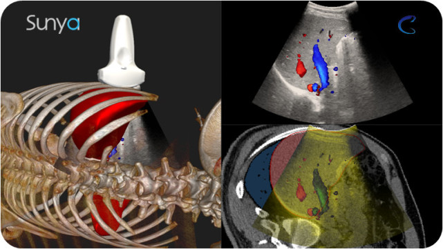 ��ģ̬Ӱ���ںϽ�ѧģʽ