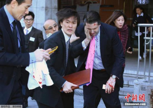 俄大使遭枪杀震惊全球 盘点5年来外交官遇袭事件