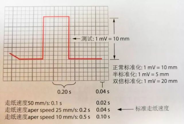 图4 标准电压了解了什么是标准电压,我们对3个病例的心电图再次进行