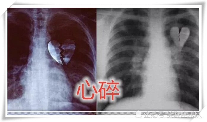 同样是"照x光"猫爪可爱,心碎难疗,最后:人间高手隐匿于此!